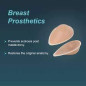 Tynor Breast Prosthesis, B30/75 (H-19)