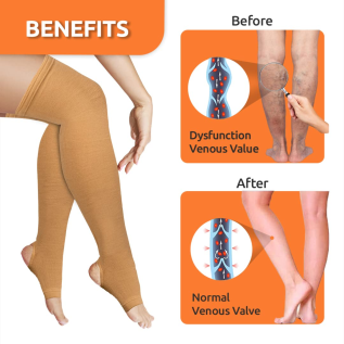 Vissco Varicose Vein Stockings for leg pain and swelling