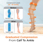 Vissco PC 5702 Compression Stockings – Class II Thigh Length Medical Support for Enhanced Leg Circulation & Recovery