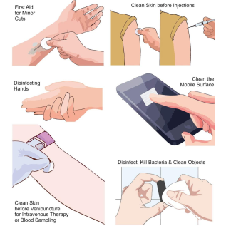 Control D Alcohol Swab – Sterile Disposable Medical Swab