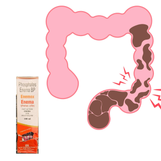 Sodium Phosphate Enema for Fast Relief with Disposable Enema Kit and Bowel Cleansing Solution
