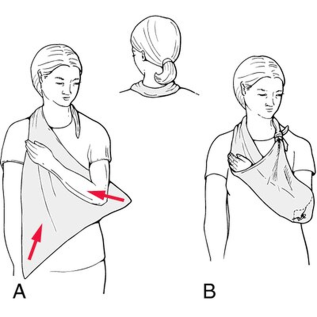 Triangular Bandage – Rossify First Aid Bandage