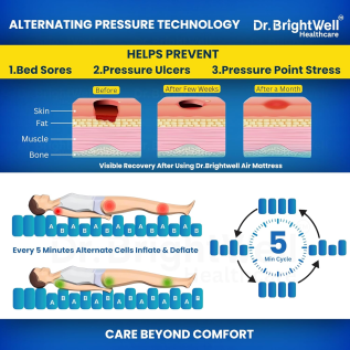 Comfortable Anti Bedsore Air Mattress medical bed setup