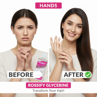 Rossify Pure Glycerine – Natural Skin Moisturizer