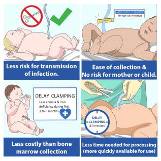 Rossify Cord Clamp | Sterile Umbilical Clamp