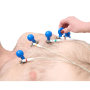 High-Performance Rossify ECG Bulb in Use