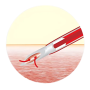 Polymed Nouvo Safety Set with sterile Safety Closed I.V. Catheter System
