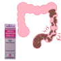 Easy colon cleanse using Rossify Enemox Enema - Sodium Phosphates