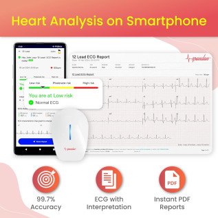Sunfox Spandan 4.0 Portable 12-Lead ECG Device | Portable ECG Machine for Home | Heart Rate Monitor | Get a Live Demo - 6