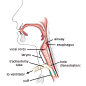 BLUselect Cuffed Tracheostomy Tubes