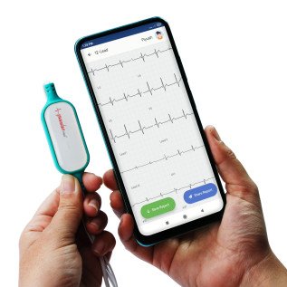 Sunfox Spandan Neo|Portable ECG Device|Specially Designed for Personal Use|Easy to Use12 Lead ECG Device|99.7% Accuracy